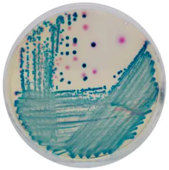 CHROMagar™ mSuperCARBA™