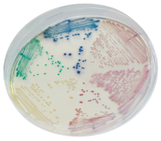 Chromogenic Chromagar™ táptalajok