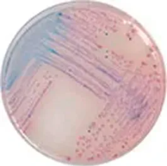 CHROMagar™ Salmonella